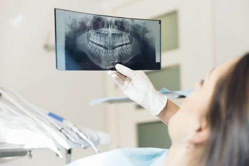 How is a dental X-ray performed?