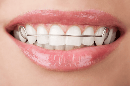 What is the maintenance function? Why wear retainers?