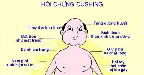 
Trường hợp tự ý sử dụng corticoid hiệu lực mạnh liên tục có thể gây ra hội chứng Cushing
