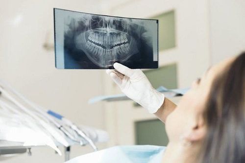Tại sao phải chụp X-quang trước khi niềng răng?