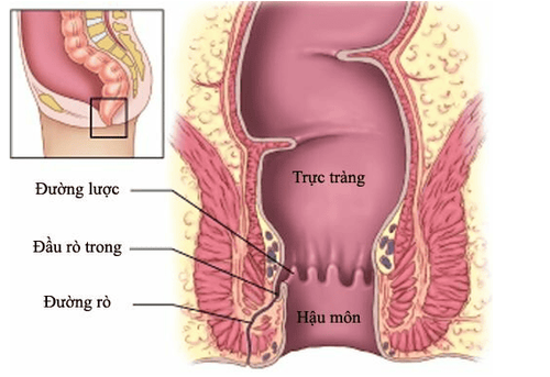 Magnetic resonance imaging procedure for anorectal fistula