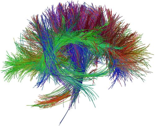 Magnetic resonance imaging of nerve fiber bundles for the diagnosis of invasive brain tumors