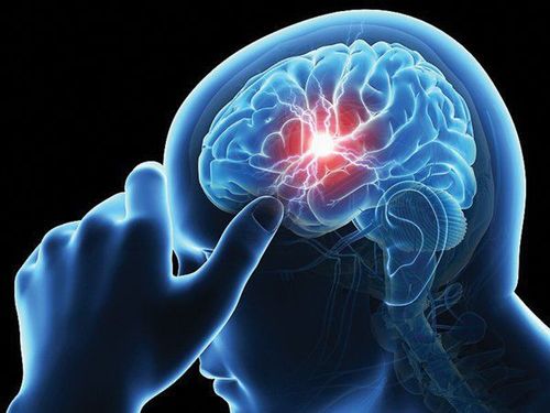 
Bệnh nhân u não được chỉ định chụp MRI sọ não
