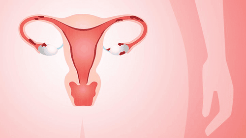 Tăng sức cản động mạch tử cung ảnh hưởng đến thai kỳ như thế nào?