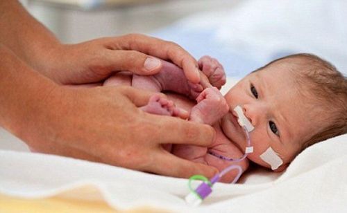 Health problems premature babies may face