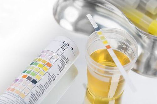 Xét nghiệm nước tiểu 24h protein niệu:0,145 H có cao không và nên dùng thuốc nào điều trị?