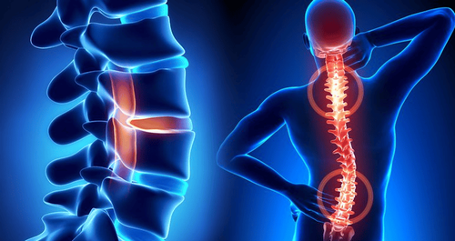 CT scan of the thoracic spine without contrast injection