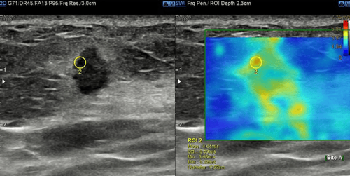 How did ultrasound come into being?