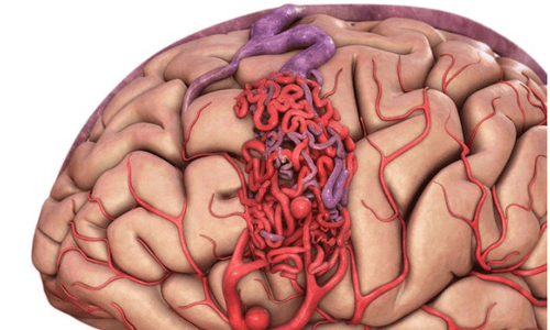 Notes on magnetic resonance imaging (MRI) of the brain and spinal cord