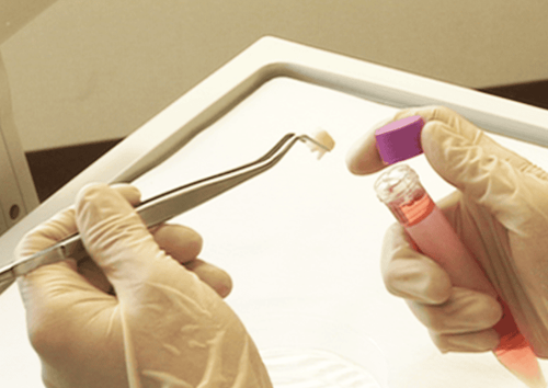 Thu nhận và lưu trữ tế bào gốc từ tủy răng sữa