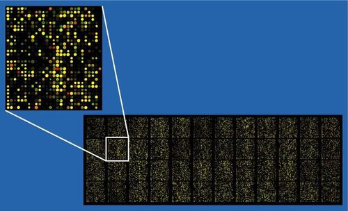 Ứng dụng của microarray trong trường hợp sảy thai liên tiếp