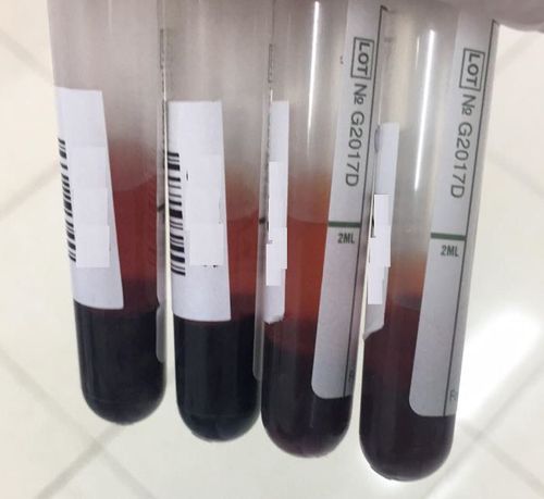 How does a blood sample with broken red blood cells affect the test results?