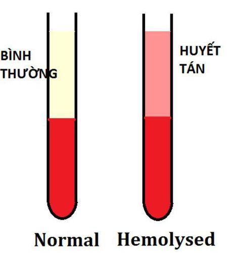 
Hình ảnh phân biệt máu vỡ hồng cầu (huyết tán)
