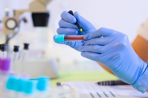 Xét nghiệm anti HCV là xét nghiệm gì?