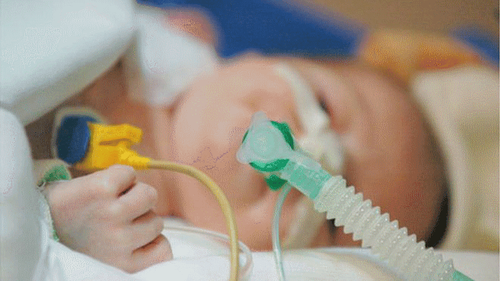 Some common respiratory failure in infants