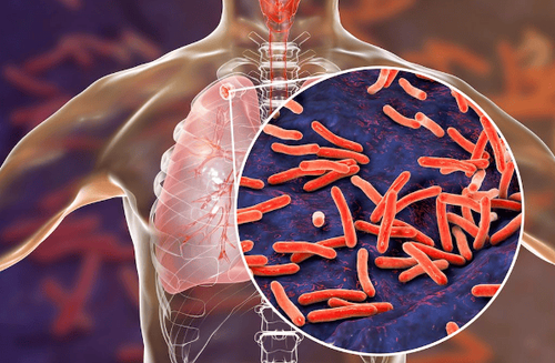 Principles of treatment of drug-resistant tuberculosis