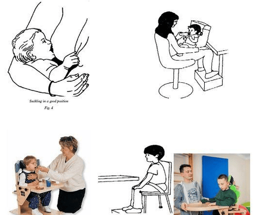 
Hình ảnh: Tư thế ăn cho trẻ bại não. Nguồn:https://www.physio-pedia.com/Feeding_the_Child_with_Cerebral_Palsy_-_a_speech_therapists_perspective
