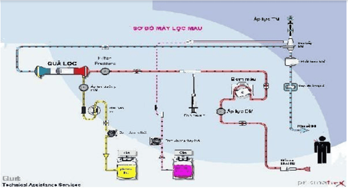 
Hình: Sơ đồ hệ thống tuần hoàn ngoài cơ thể khi thay huyết tương
