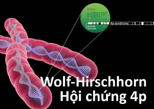 
Nguyên nhân gây ra hội chứng Wolf-Hirschhorn là do rối loạn nhiễm sắc thể
