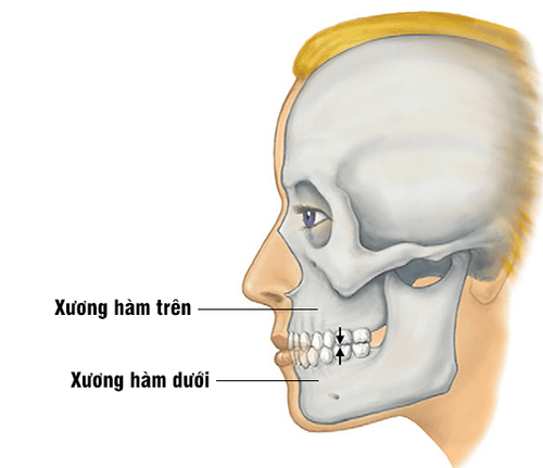 Diagnosis and treatment of maxillary fractures