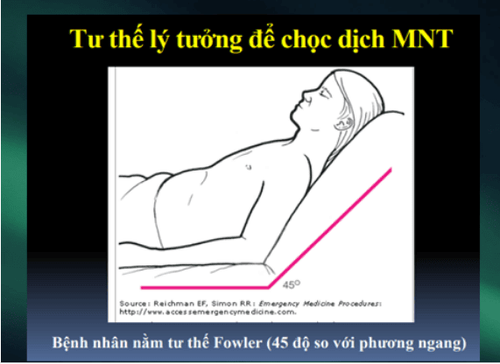 What is acute tamponade? Signs of recognition and treatment