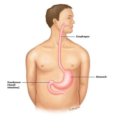 
Nội soi đường tiêu hóa trên, thường được gọi là nội soi dạ dày hoặc nội soi dạ dày - tá tràng
