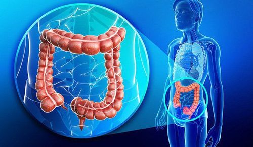 Common types of malignancies in the colon