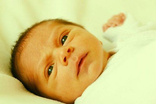 Trẻ sơ sinh bị vàng da nhiều ở phần mặt và trong mắt hơn 1 tháng có sao không?