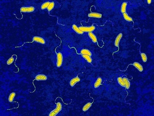 Characteristics of cholera Vibrio Cholerae