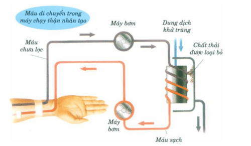 
Lọc máu là một phương pháp điều trị bệnh viêm não tự miễn
