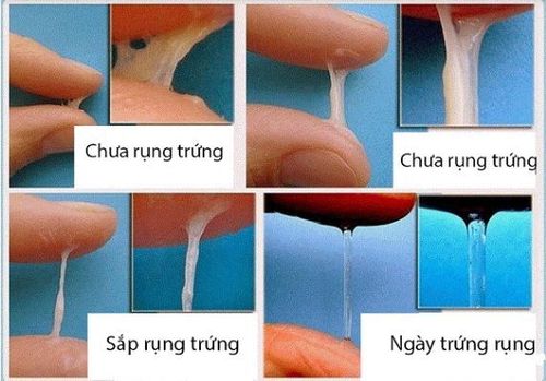 
Chất nhầy gần giống lòng trắng trứng gà báo hiệu sắp tới ngày rụng trứng
