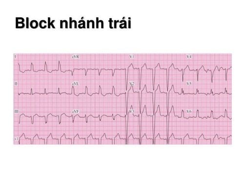 
Hình ảnh block nhánh trái
