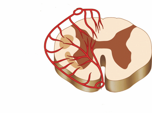 Vascular pathologies of the spinal cord (Part 1)