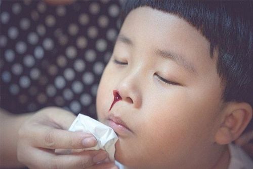 Trẻ 6 tuổi thường chảy máu mũi lúc ngủ dấu hiệu bệnh gì?