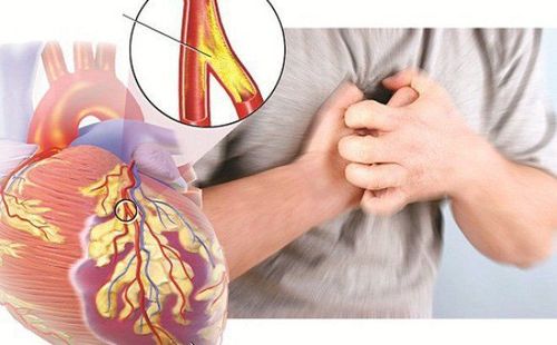 Tăng Troponin huyết thanh ngoài hội chứng vành cấp