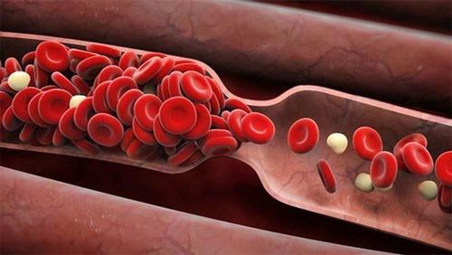 Symptoms and causes of poor blood circulation