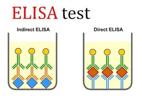 
Xét nghiệm ELISA là một phương pháp chẩn đoán HIV
