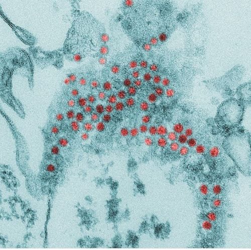 
Hình anh virus Enterovirus 71 - virus gây bệnh tay chân miệng
