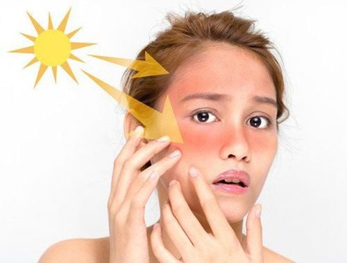 Prevention of skin inflammation caused by the sun