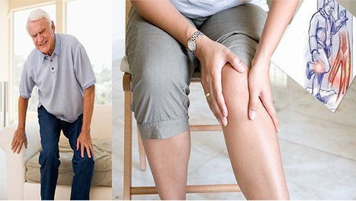 
Tiêu chuẩn vàng chẩn đoán bệnh gout là tìm thấy tinh thể urat trong dịch khớp hoặc hạt tophi
