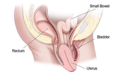 What do you know about inverted uterus?