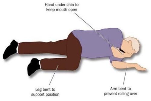 Basic life support and circulatory arrest