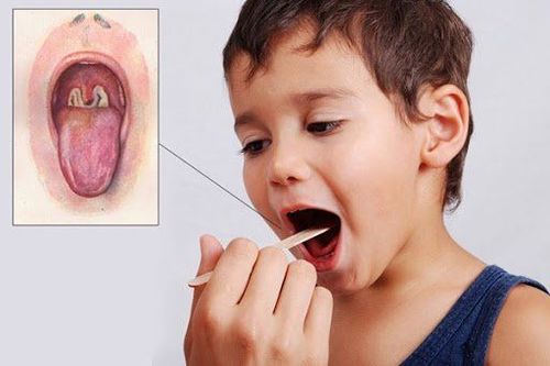 Why is laryngeal diphtheria in children dangerous?