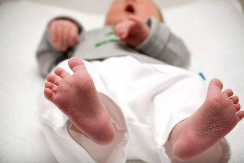 When to do newborn screening?