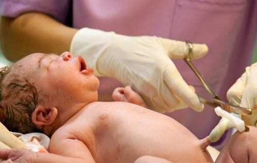 You will be surprised to know why the doctor turned the baby upside down after cutting the umbilical cord