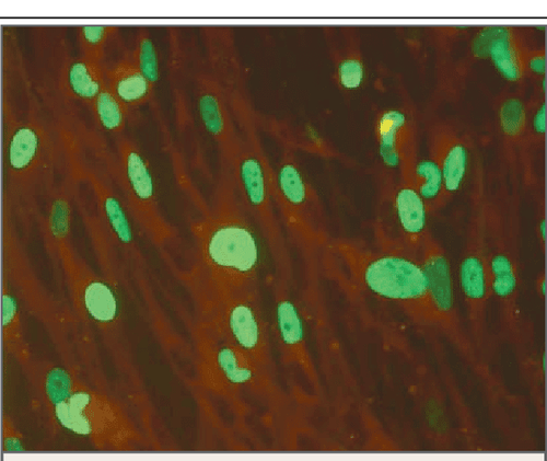 
Vết huỳnh quang miễn dịch trong xét nghiệm trong vỏ tìm cytomegalovirus
