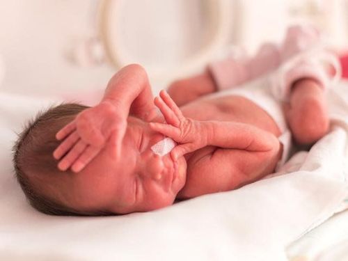 Một số trẻ sinh non phát triển vấn đề viêm ruột hoại tử sơ sinh từ hai đến ba tuần sau khi sinh