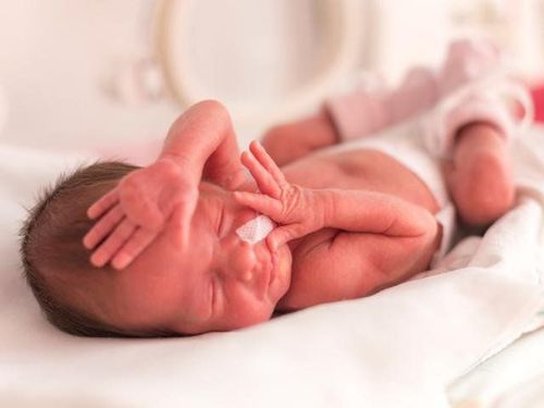 
Ở tuần thứ 33 và 34, hầu hết trẻ sinh non sẽ có thời gian NICU khá ngắn
