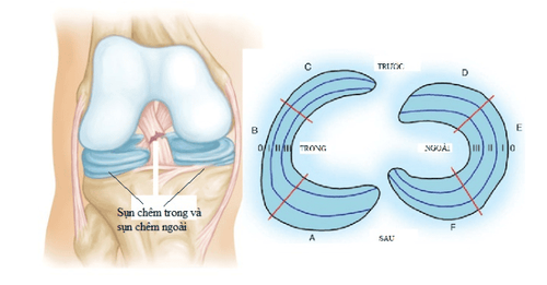 Điều trị bảo tồn và phẫu thuật rách sụn chêm được thực hiện trong trường hợp nào?