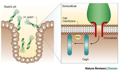 
H. pylori cagA dương tính có nguy cơ ung thư biểu mô tuyến thực quản giảm có ý nghĩa thống kê
